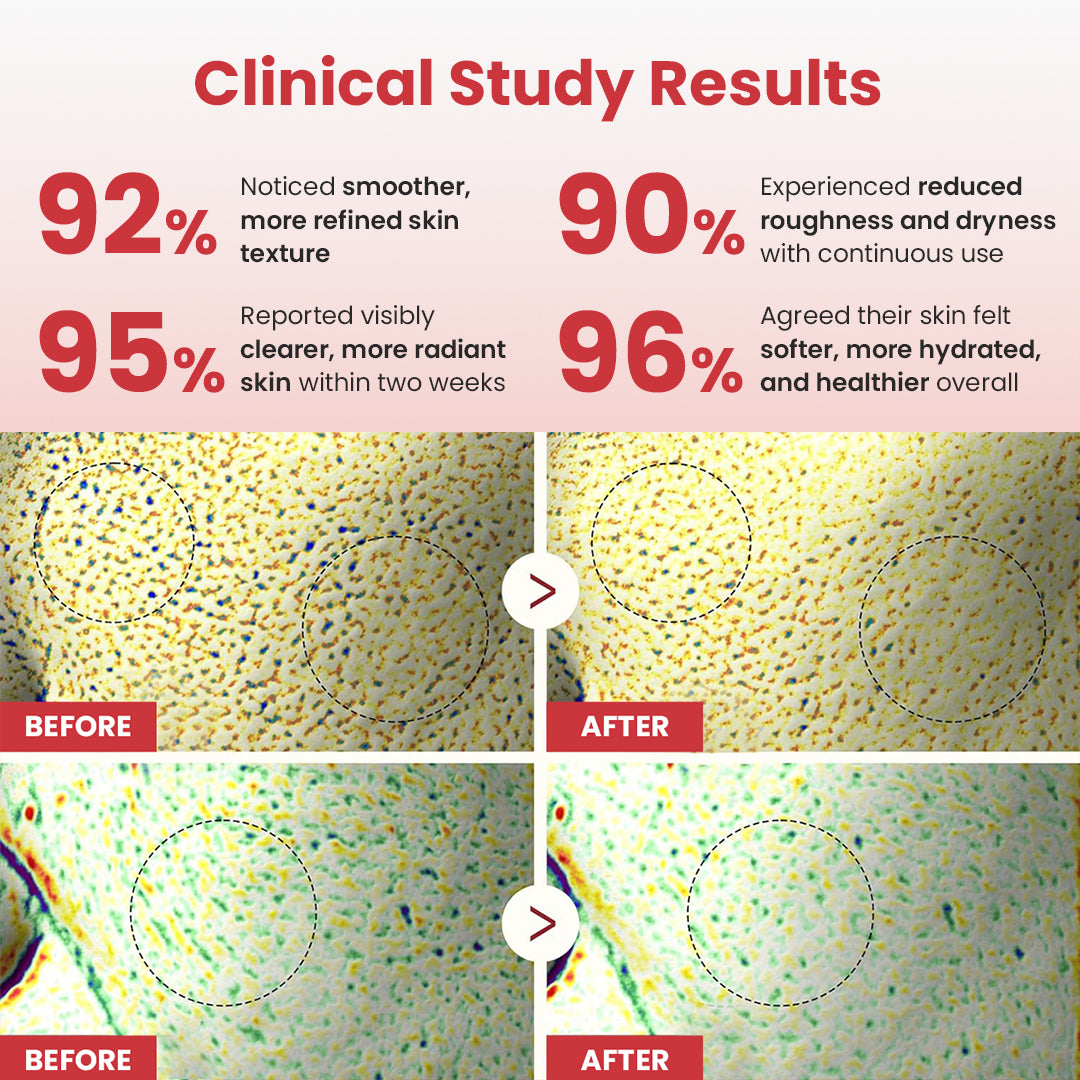 Hypochlorous Rice Duo Serum | Gentle Exfoliation & Hydrating Care for Clogged Pores & Rough Skin