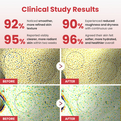 Hypochlorous Rice Duo Serum | Gentle Exfoliation & Hydrating Care for Clogged Pores & Rough Skin