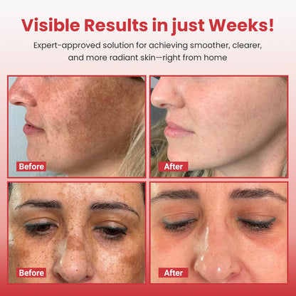 Hypochlorous Rice Duo Serum | Gentle Exfoliation & Hydrating Care for Clogged Pores & Rough Skin